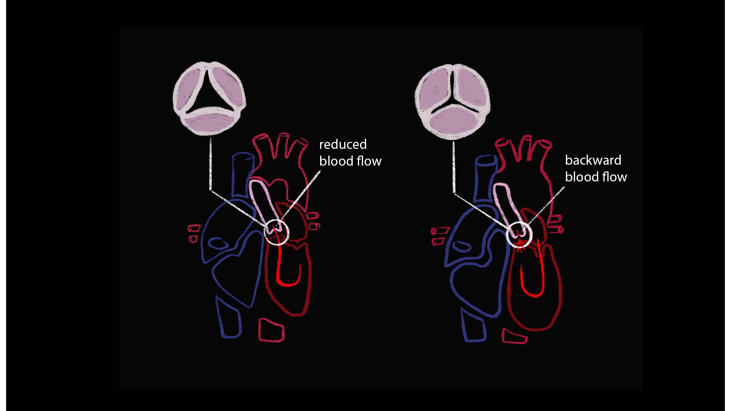 Video production for Gallery of Fluid Motion